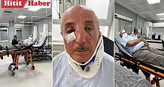 Çorum-Samsun Otoyolunda Özdil Ailesi Darp Edildi, 6 Kişi Yaralı! Saldırganlar Gözaltında.
